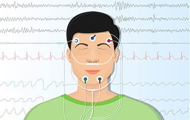Đo đa ký giấc ngủ