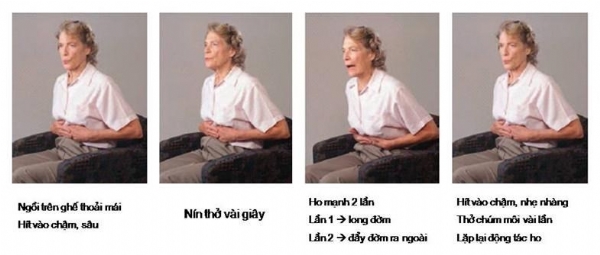 Lấy khí máu động mạch quay làm xét nghiệm